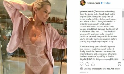SKAPTE REAKSJONER: Dette bildet delte Yolanda Hadid med følgerne sine på Instagram, og resulterte i at hun ble nødt til å forsvare barna sine mot spekulasjoner om plastisk kirurgi. Foto: Skjermdump fra Instagram/yolanda.hadid SKAPTE REAKSJONER: Dette bildet delte Yolanda Hadid med følgerne sine på Instagram, og resulterte i at hun ble nødt til å forsvare barna sine mot spekulasjoner om plastisk kirurgi. Foto: Skjermdump fra Instagram/yolanda.hadid